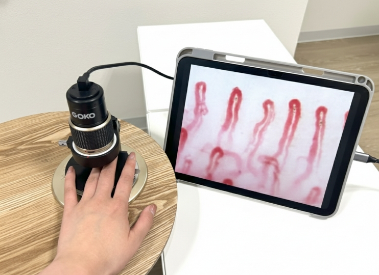 毛細血管チェック